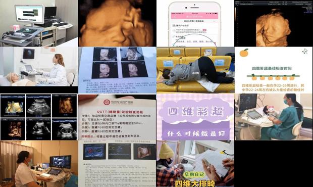 汕头四维什么时候做