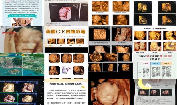 汕头四维和三维有什么区别