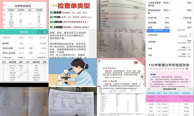 汕头白带常规检查多少钱