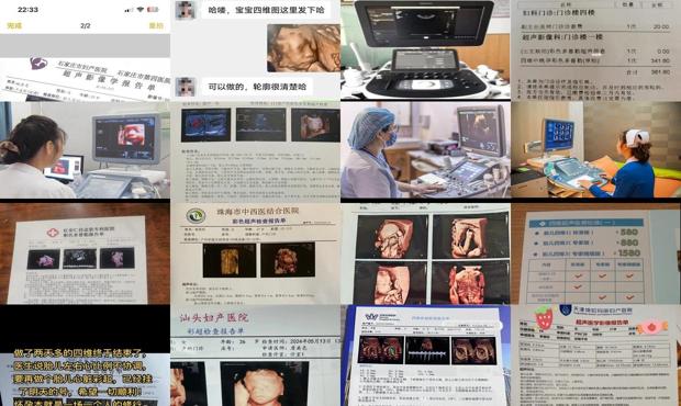 汕头四维一般多少钱