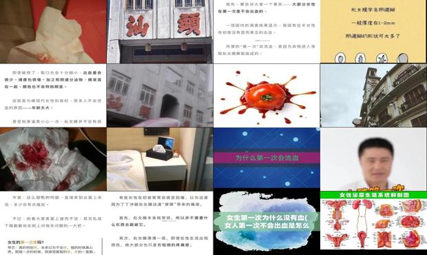汕头*次为什么会流血