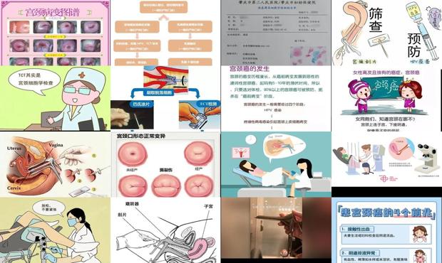 汕头如何检查宫颈
