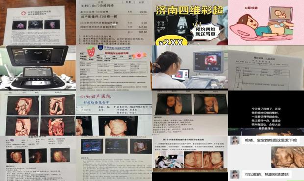 汕头查四维彩超多少钱