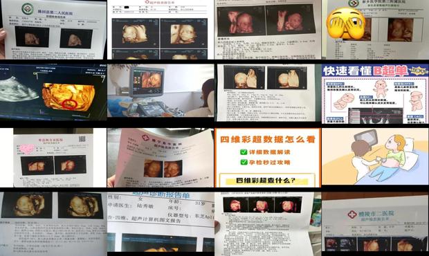 汕头孕妇几个月四维彩超