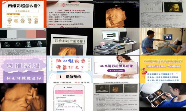 汕头四维什么时候做合适