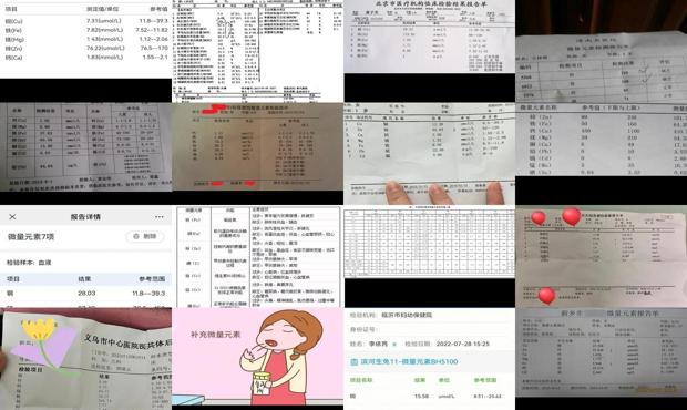 汕头微量元素检查多少钱