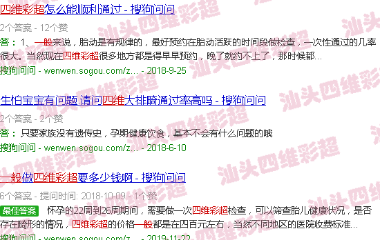 汕头四维彩超一般都能过吗