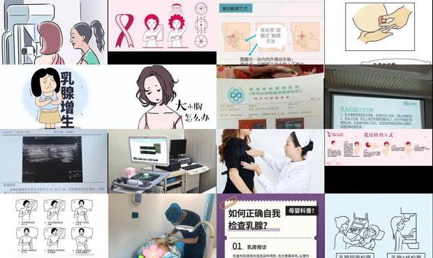 汕头检查乳房的费用