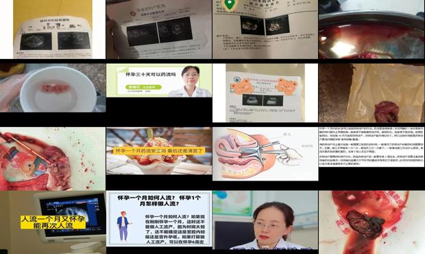 汕头怀孕一个月能药流吗