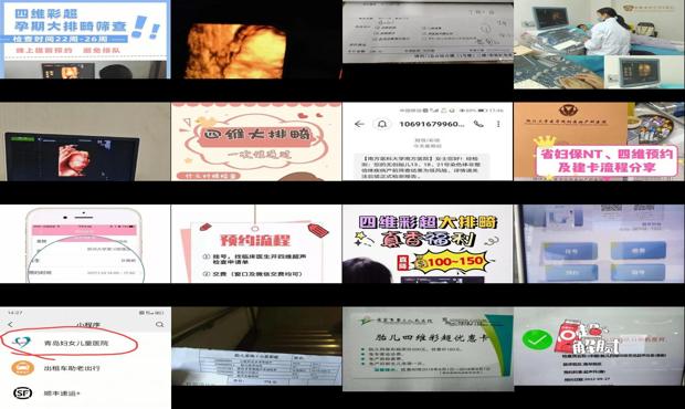 汕头四维预约吗