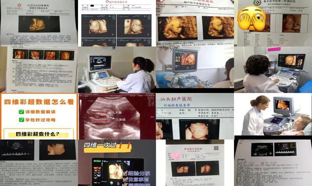 汕头怀孕几个月查四维