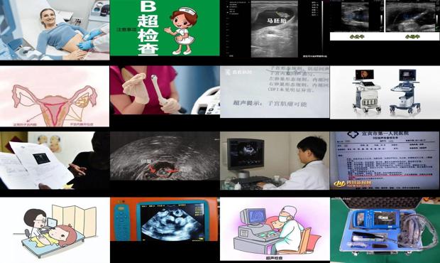 汕头b超检查子宫
