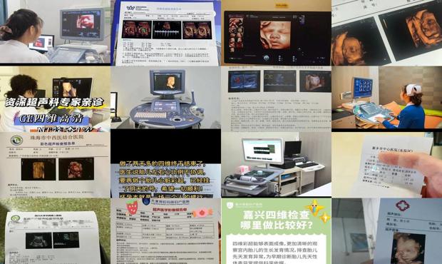 汕头四维检查多少钱