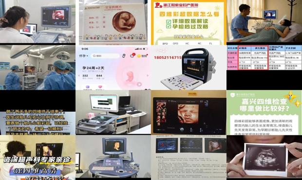 汕头查四维多少钱