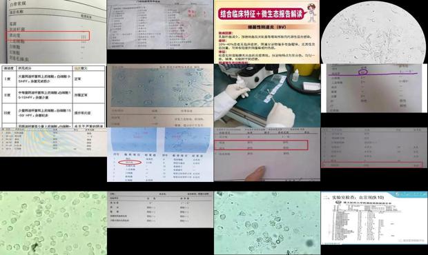汕头阴道分泌物常规检查
