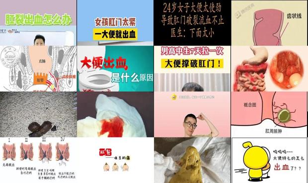 汕头大便时肛门流血怎么办