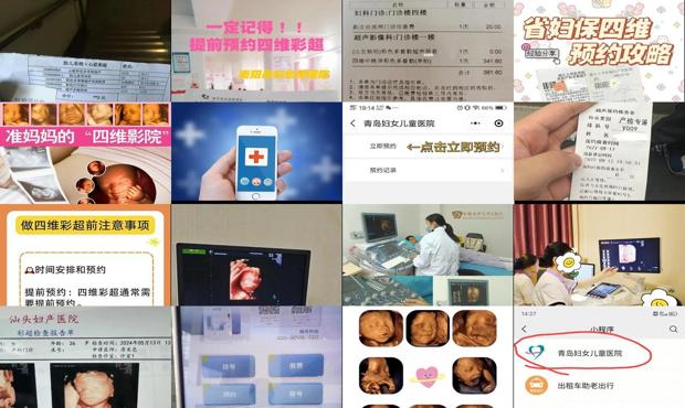 汕头四维检查预约