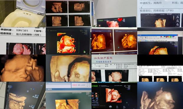 汕头四维是什么