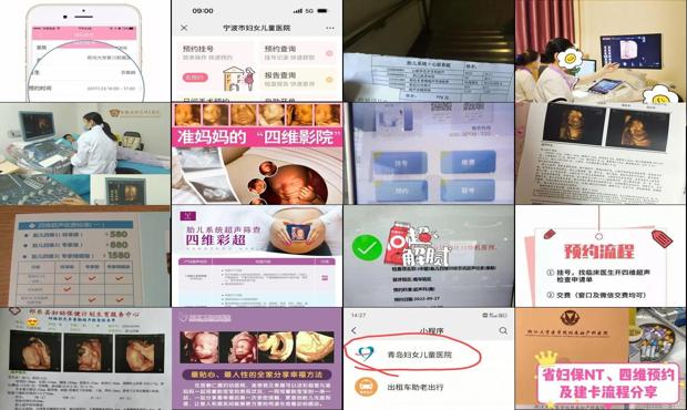 汕头四维要预约吗
