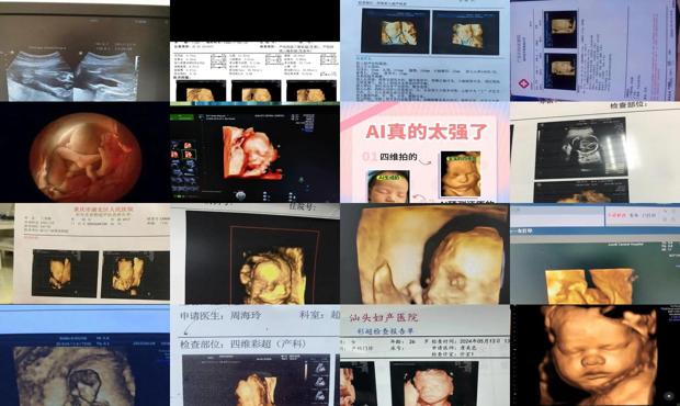 汕头四维*是彩超吗