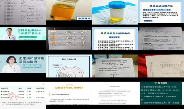 汕头检查尿常规需要空腹吗