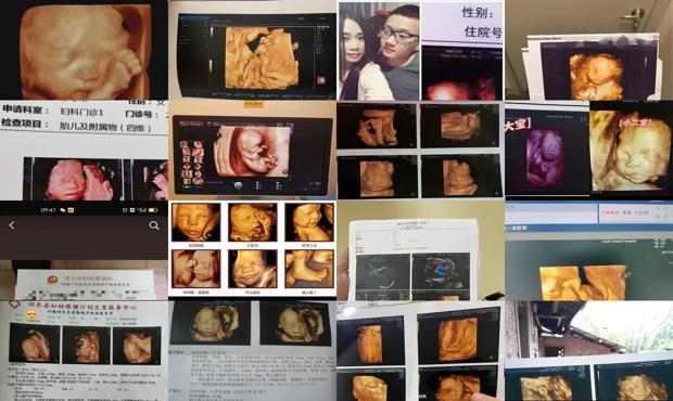 汕头21周可以做四维吗