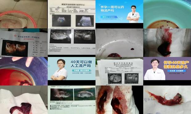 汕头怀孕40天能做流产吗
