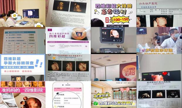 汕头预约做四维彩超