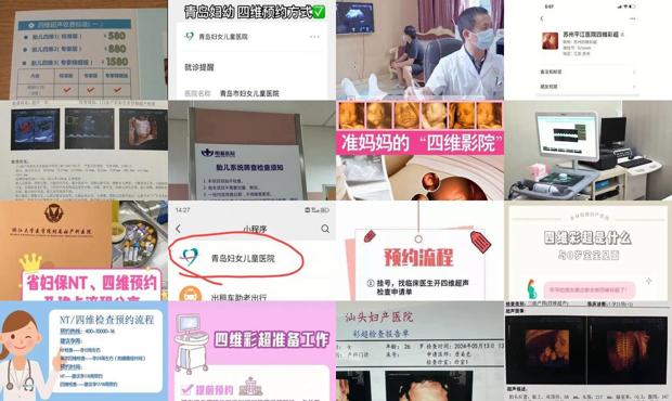 汕头为什么四维需要预约