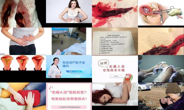 汕头流产会痛吗