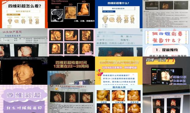 汕头四维什么时候做*佳