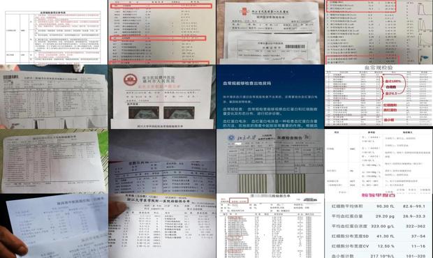 汕头血常规检查多少钱