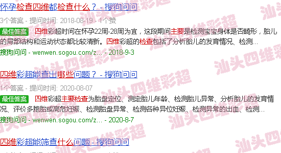 汕头四维 b超主要检查什么