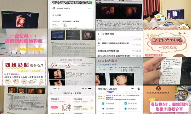 汕头四维用提前预约么