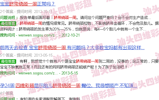 汕头四维彩超脐带绕颈一周