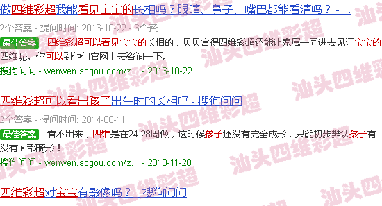 汕头四维彩超可以看到宝宝的样子吗