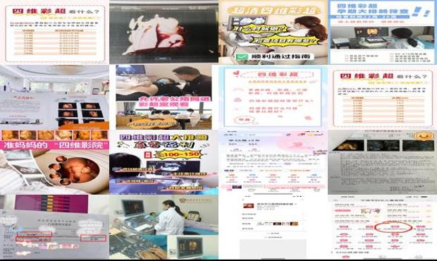 汕头网上如何预约四维彩超