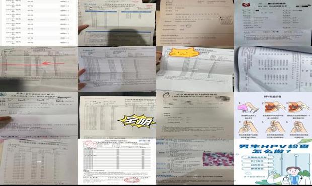 汕头hpv检查