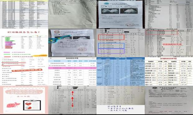 汕头医院检查肝功能多少钱