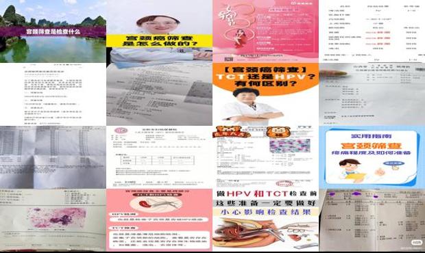 汕头宫颈筛查是检查什么