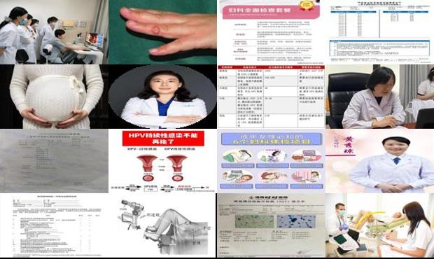 汕头阴倒镜检查的费用