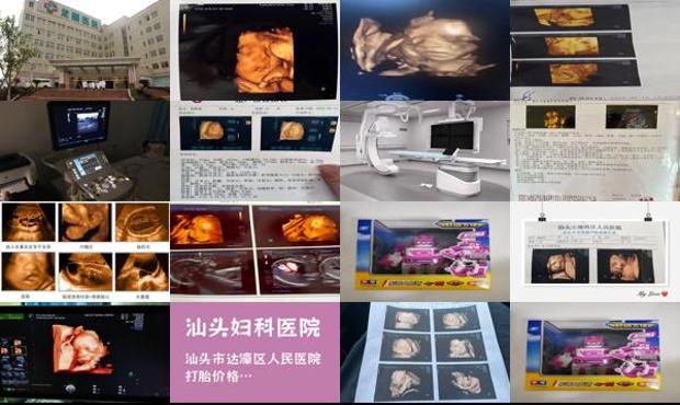 汕头四维彩超致畸