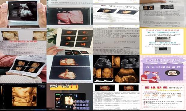 汕头四维彩超的*佳时间是多少周