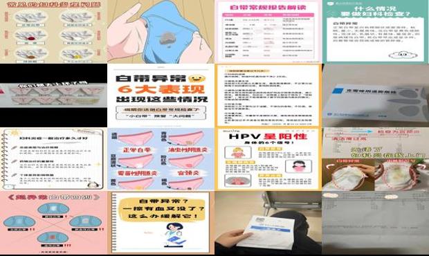 汕头白带异常怎么检查