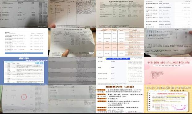 汕头什么时候检查激素六项