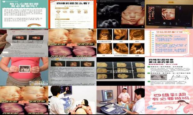 汕头四维彩超作用不大? 孕期有必要做吗