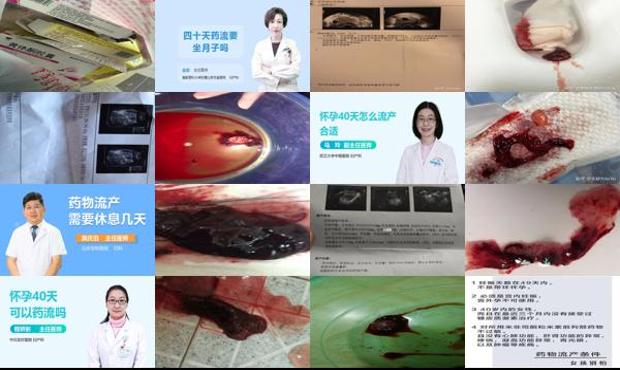 汕头怀孕40天可以吃药流吗