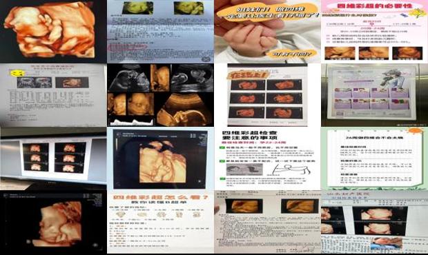 汕头做四维*佳时间