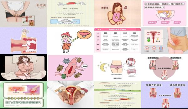 做月子下身痒是怎么回事 - 汕头做月子下面阴道痒怎么回事