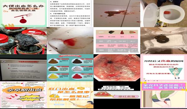 月子中大便出血怎么办 - 汕头请问月子里大便*出血是什么原因